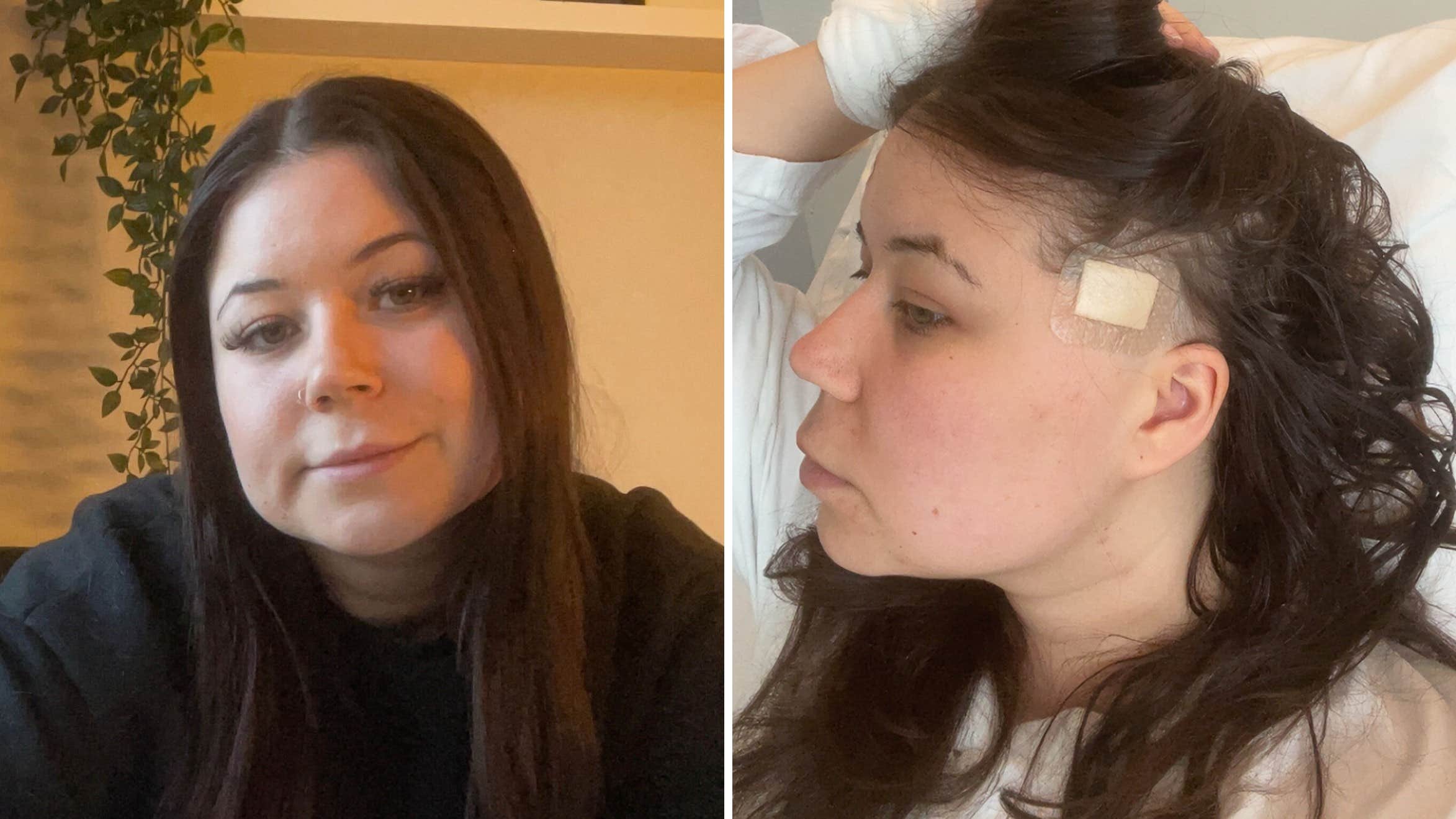 Louise, 27, hade hjärntumör – kallades häxa